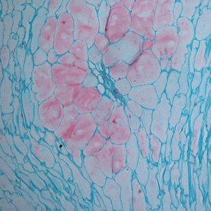 Microscopio Biológico BestScope BS-2040T con Sistema Óptico Infinito y Ocular de Campo Extra Amplio para Investigación Médica y de Laboratorio - Product Image 5