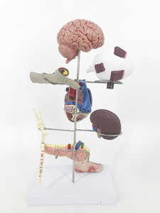 Model Patologi <span class=keywords><strong>Diabetes</strong></span> Manusia 8 Bagian untuk Pengajaran - Product Image 3