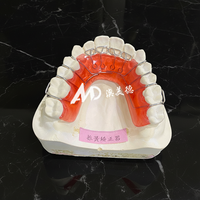 Aligneur dentaire à ressort amovible pour la correction des dents |   Appareil de rétention orthodontique