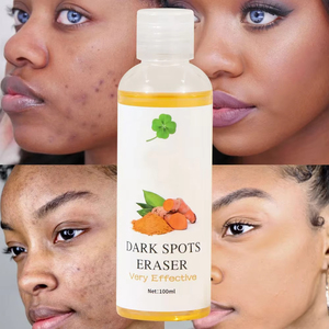 น้ำยาลบจุดด่างดำช่วยให้ผิวกระจ่างใสแม้โทนสีผิวลบเลือนสิวเพื่อผิวขาวลดสิว - Product Image 2