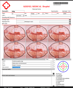 कर्नेल कोलोपोस्कोन 2200 योनि और वल्वा की महिलाओं की जांच के लिए अस्पताल स्त्री रोग परीक्षण - Product Image 6