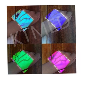 Alat Bedah Basis Pencitraan Pembentuk Gambar untuk Melihat Pembuluh Darah, Pencari Pembuluh Darah Wajah, Pemindai Pembuluh Darah Inframerah - Product Image 6