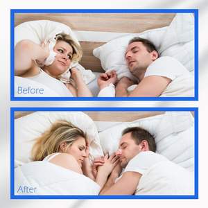 Tiras Nasales YOJO OEM Sin Látex, Impermeables, Hipoalergénicas, Transpirables, con Certificación CE y 3 Años de Garantía para Ronquidos - Product Image 4