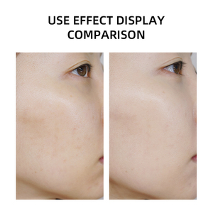 Soins du visage Collagène Taches sombres Hydratant Anti-âge Rides Peau éclatante 24K Noir Truffe Or Crème pour le visage pour les femmes - Product Image 3