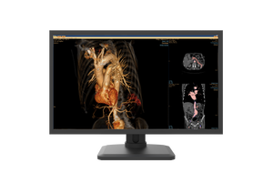 शीर्ष गुणवत्ता 4 एमपी रंग ग्रे चिकित्सा नैदानिक प्रदर्शन - Product Image 3