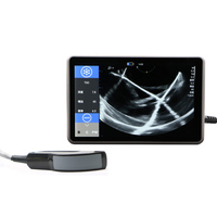 Ecógrafo Doppler Color Veterinario Portátil ECI-X7 para Perros, Gatos y Mascotas, Sistema de Diagnóstico con Pantalla Táctil de 10 Pulgadas, IPX6