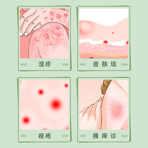 Gel médical pour la peau Sunflower 20g, médicamenteux, pour bébé et tous types de peau, soulagement de la dermatite, de l'acné et de l'eczéma - Product Image 3
