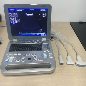 Ecocardiografie Kleur <span class=keywords><strong>Doppler</strong></span> Scan Cw Draagbare 128 Elementen Echografie Machine - Product Image 3