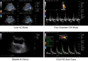SYA-M5 3 डी 4 डी रंग डॉपलर लैपटॉप कार्डियक अल्ट्रासाउंड सिस्टम - Product Image 6