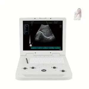 Tierklinik Kuh-Schwangerschaftsausrüstung tragbares Laptop-Gerät Digital-Ultraschall-Scanner Preis