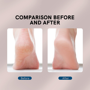 Lime électrique pour les pieds, outil de pédicure professionnel pour éliminer les peaux mortes et les callosités, soin des pieds, soin de beauté - Product Image 6