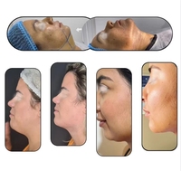 Appareil de liposuccion Vaser Endolaser 1470nm+980nm, lipolyse laser, lifting facial Endo Laser