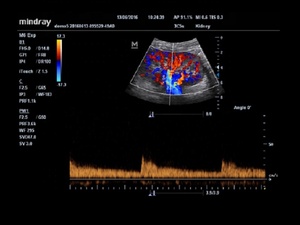 Máquina de ultrasonido <span class=keywords><strong>Doppler</strong></span> a <span class=keywords><strong>color</strong></span> digital completo portátil Mindray M6 M55 con calidad perfecta - Product Image 5
