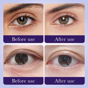Parches de Hidrogel para el Cuidado de los <span class=keywords><strong>Ojos</strong></span> SADOER al por Mayor, Parches de Gel Antienvejecimiento para los <span class=keywords><strong>Ojos</strong></span>, Parches de Colágeno con Semillas de Uva para Debajo de los <span class=keywords><strong>Ojos</strong></span> - Product Image 6