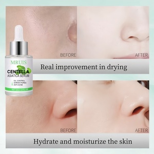 Suero <span class=keywords><strong>de</strong></span> Centella Asiática <span class=keywords><strong>de</strong></span> 30 ml al por Mayor, Marca Privada, Control <span class=keywords><strong>de</strong></span> Grasa, Reduce Poros, Anti-Acné, Calmante e Hidratante para Piel Propensa al Acné - Product Image 4