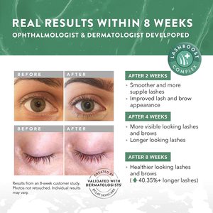 Sérum Natural a Prueba de Agua <span class=keywords><strong>para</strong></span> <span class=keywords><strong>Pestañas</strong></span> <span class=keywords><strong>y</strong></span> <span class=keywords><strong>Cejas</strong></span> con Efecto Rizador <span class=keywords><strong>y</strong></span> Alargador <span class=keywords><strong>para</strong></span> <span class=keywords><strong>Pestañas</strong></span> Más Largas, Se Aceptan Marcas Privadas - Product Image 3