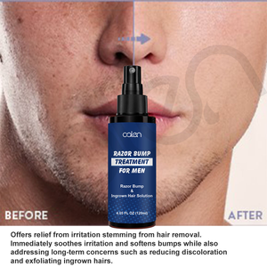 Solution Après-Rasage Apaisante Contre les Boutons de <span class=keywords><strong>Rasoir</strong></span> et les Poils Incarnés pour Hommes et Femmes – Marque Blanche - Product Image 3