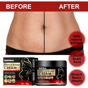Crème pour les vergetures de <span class=keywords><strong>grossesse</strong></span>, naturelle et biologique, pour femmes, crème post-partum contre les vergetures - Product Image 5