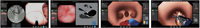 Simulateur d'endoscopie virtuelle portable pour la formation des résidents en chirurgie digestive et respiratoire (gastroscopie, bronchoscopie)
