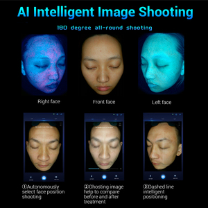 เครื่องวิเคราะห์ผิวหน้า Ai แบบพกพาเทคโนโลยีใหม่พร้อมปากกาวัดความชื้นหน้าจอขนาดใหญ่15.6นิ้ว16ภาษา - Product Image 4