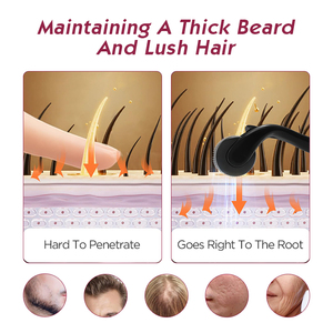 Vente flash : Rouleau de derme en titane pour le visage, 540 aiguilles, 0,25 mm-2,5 mm, pour rajeunir la peau et favoriser la croissance des cheveux - Product Image 4