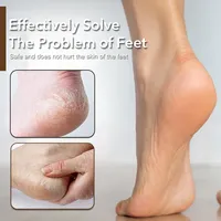 Râpe à talon en acier inoxydable pour les pieds, râpe à pédicure, outils de manucure de luxe
