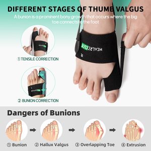 Correcteur d'<span class=keywords><strong>hallux</strong></span> <span class=keywords><strong>valgus</strong></span>, séparateur d'orteils, correcteur de bunions, attelle d'orteils en néoprène, redressement des orteils, <span class=keywords><strong>sport</strong></span> - Product Image 4