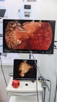 Endoscope électrique IKEDA YKD-9132 4K avec source lumineuse 100W, système de caméra médicale pour laparoscopie et ORL