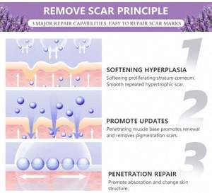 Soins de la peau du corps et du visage, élimine les cicatrices de grossesse, l'acné, les brûlures chirurgicales, crème d'élimination des cicatrices - Product Image 6