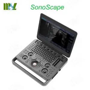 Advanced and Portable sonoscape X3 Digital Color Doppler Ultrasonic Machine