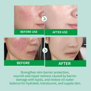 Ampoule réparatrice de la barrière lipidique pour la peau, fortifiant et équilibrant l'hydratation, traitement nourrissant en profondeur, qualité professionnelle de clinique dermatologique - Product Image 3