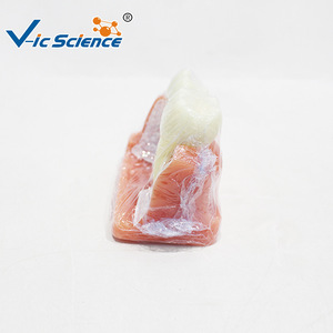 Modèle d'implant triple couronne en argent ; modèle de démonstration de communication dentaire médecin-patient - Product Image 2
