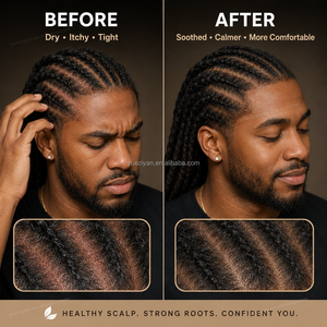 Sérum Apaisant pour Cuir Chevelu Sec et Tendu à l'Hamamélis, Biotine et Miel, Marque Blanche, pour Tresses et Locs - Product Image 6