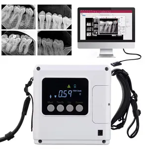 جهاز الأشعة السينية للأسنان من Runyes الأصلي بقوة 70 كيلو فولت وحدة الأشعة السينية عالية التردد جهاز الأشعة السينية للأسنان محمول منخفض الإشعاع بنظام التصوير بالأشعة السينية