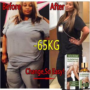 Minyak Esensial Pelangsing Penghilang Selulit Label Pribadi untuk Membakar Lemak bagi Pria & Wanita - Product Image 2