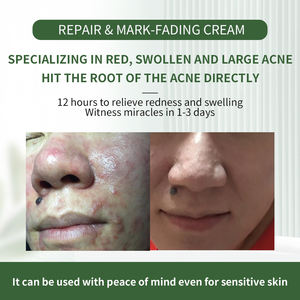 Crème anti-acné à base de plantes <span class=keywords><strong>en</strong></span> vrac KG - <span class=keywords><strong>Produit</strong></span> semi-fini - Matière première <span class=keywords><strong>en</strong></span> <span class=keywords><strong>gros</strong></span> pour l'atténuation des marques et des cicatrices d'acné - Product Image 4