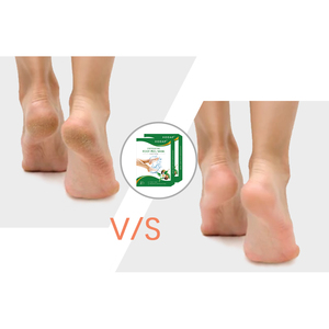 पेपेन एलोई एसिड फुट मास्क थोक वितरकों के लिए मॉइस्चराइजिंग - Product Image 3