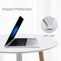 Coque rigide en marbre d'impression OEM et housse de clavier pour Macbook Air M1 M3 M4 13.3 pouces Pro 14 pouces 15 pouces 16 pouces