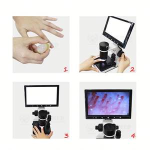 SY-B198 의료용 생물 현미경 혈액 검사 손톱 주름 모세혈관 미세순환 현미경 - Product Image 3
