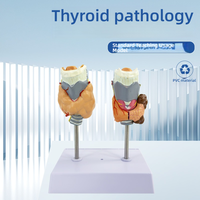 Modèle anatomique de la glande thyroïde en PVC pour la science médicale, pour l'enseignement de l'hyperthyroïdie et de l'hypothyroïdie, écoles