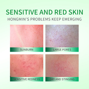 Chống-đỏ sửa chữa trên khuôn mặt huyết thanh màu xanh lá cây Centella asiatica cho làn da nhạy cảm làm dịu tăng cường hàng rào da làm dịu chăm sóc - Product Image 3