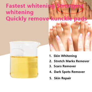 Huile Éclaircissante pour les Taches Sombres des Articulations, Crème Blanchissante la Plus Efficace, Crème Corporelle Forte pour Éliminer les Taches Noires, Ingrédients Pré-Mélangés - Product Image 4
