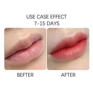 <span class=keywords><strong>Petit</strong></span> <span class=keywords><strong>secret</strong></span> de beauté n°2 Crème cache-cernes vaginale rose Naturelle Biologique Blanchissante Nourrissante Anti-rides 10g Utilisation corporelle pour tous - Product Image 3