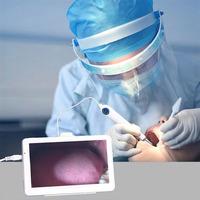 Endoscope ENT avec écran HD de 10 pouces, caméra de 3,9 mm, otoscope pour l'inspection des oreilles, du nez et de la gorge, avec batterie rechargeable