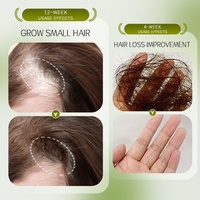Serum Penumbuh Rambut Organik Hairarouse Dengan Ekstrak Herbal untuk Pertumbuhan Kembali Rambut Mengurangi Kerontokan Rambut 50ml Perawatan Kulit Kepala Grosir