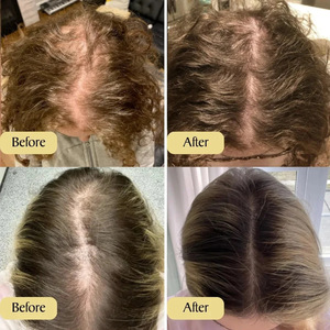 Fabbrica Private Label 100% naturale per capelli <span class=keywords><strong>di</strong></span> <span class=keywords><strong>rosmarino</strong></span> <span class=keywords><strong>olio</strong></span> <span class=keywords><strong>essenziale</strong></span> per la crescita rapida dei capelli trattamento del siero per la crescita rapida dei capelli <span class=keywords><strong>olio</strong></span> - Product Image 3