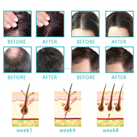 Label privé 100% naturel à base de plantes nourrissant élixir pour le cuir chevelu huile de ricin romarin soin des cheveux traitement de la perte de cheveux sérum d'huile de croissance des cheveux