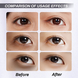 Potente Crema <span class=keywords><strong>Contorno</strong></span> <span class=keywords><strong>de</strong></span> <span class=keywords><strong>Ojos</strong></span> con Retinol Personalizada <span class=keywords><strong>de</strong></span> Fábrica, Reduce las Líneas Finas y las Ojeras, Estimula la Síntesis <span class=keywords><strong>de</strong></span> Colágeno - Product Image 5