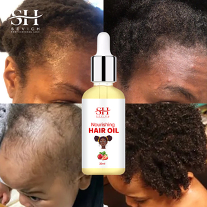 Aceite de ricino natural de etiqueta privada, vitamina E, aceite de <span class=keywords><strong>suero</strong></span> para el crecimiento del cabello para <span class=keywords><strong>niños</strong></span>, antipérdida de cabello - Product Image 6