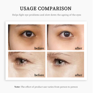OEM / ODM vente en gros meilleurs produits de soins de la peau biologique crème pour les yeux <span class=keywords><strong>Anti</strong></span>-âge et <span class=keywords><strong>Anti</strong></span>-rides pour femmes - Product Image 6